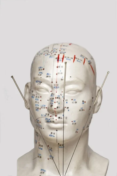 Akupunktúrás Tűk Zár Megjelöl Szemcsésedik — Stock Fotó