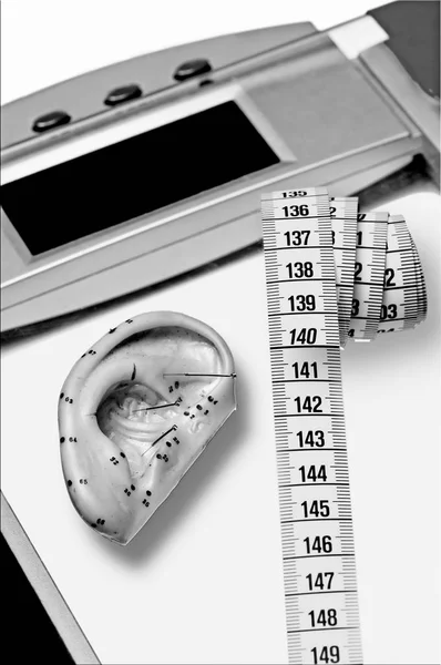 Acupunctuur Voor Weight Loss Close Shot — Stockfoto