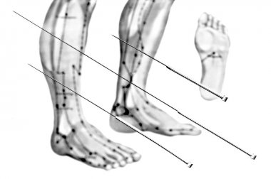 Akupunktur iğneleri atış kapatın