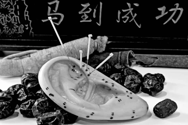 Agulhas Acupuntura Modelo Orelha Ervas Chinesas — Fotografia de Stock
