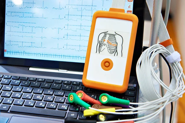 Equipamento médico portátil para ECG — Fotografia de Stock