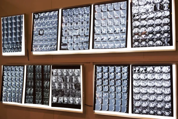 Imagens de raios-X de partes do corpo — Fotografia de Stock
