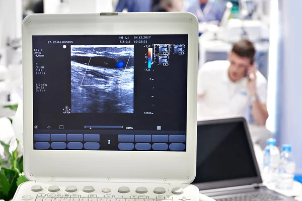 Ultrasonido en clínica y médico — Foto de Stock