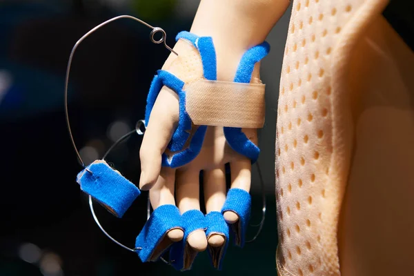 Mankenler üzerinde el için ameliyat sonrası bandajları — Stok fotoğraf