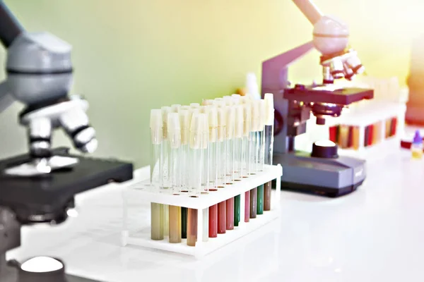 Lékařské Mikroskopy Vzorky Biofluidů Zkumavkách — Stock fotografie