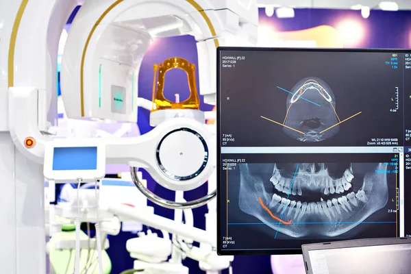 Moderní Zubní Digitální Tomograf — Stock fotografie