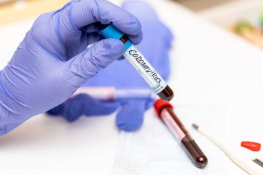 Coronavirus kan analizi konsepti. Solunum maskeli laboratuar masası, steteskop, kan dolu test tüpleri, haplar. 2019-ncov Coronavirus kökenli Wuhan, Çin