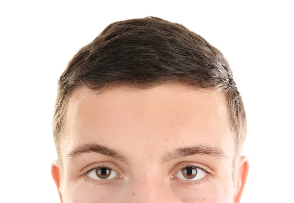 Hombre joven con acné problema sobre fondo blanco — Foto de Stock