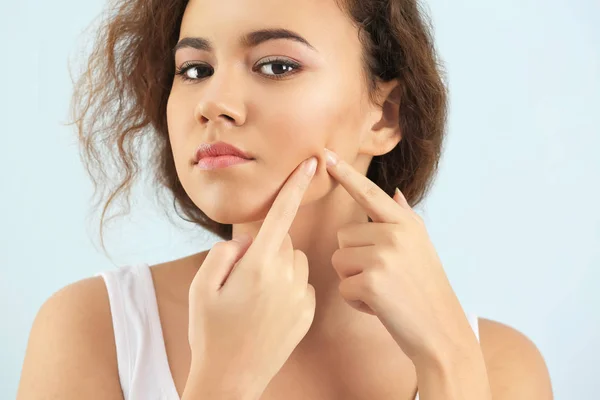 Mooie jonge vrouw met acneprobleem op lichte achtergrond — Stockfoto