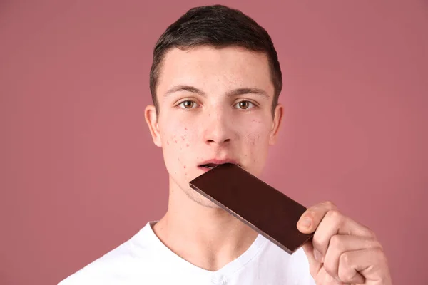 Hombre joven con problemas de acné comer barra de chocolate en el fondo de color. Alergia cutánea — Foto de Stock