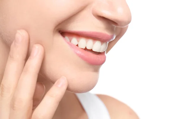 Mujer joven con hermosa sonrisa sobre fondo blanco, primer plano. Blanqueamiento dental —  Fotos de Stock