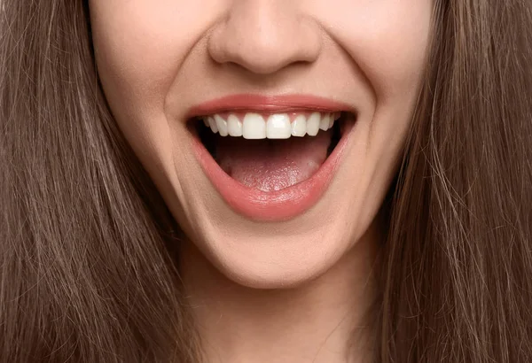 Młoda kobieta z pięknym uśmiechem, zbliżenie. Wybielanie zębów — Zdjęcie stockowe
