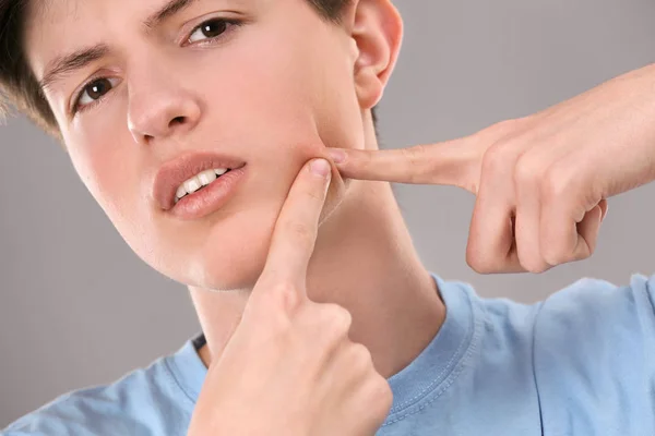 Tiener met acneprobleem op grijze achtergrond — Stockfoto