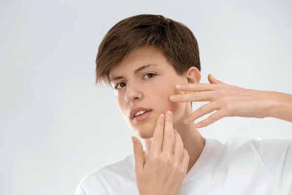 Menino adolescente com problema de acne no fundo claro — Fotografia de Stock