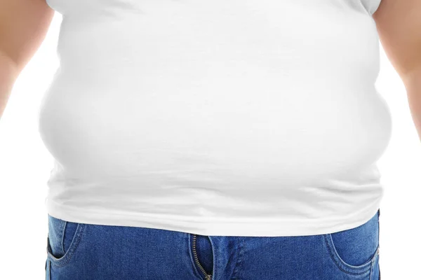 하얀 배경 의과 체중 여성 — 스톡 사진