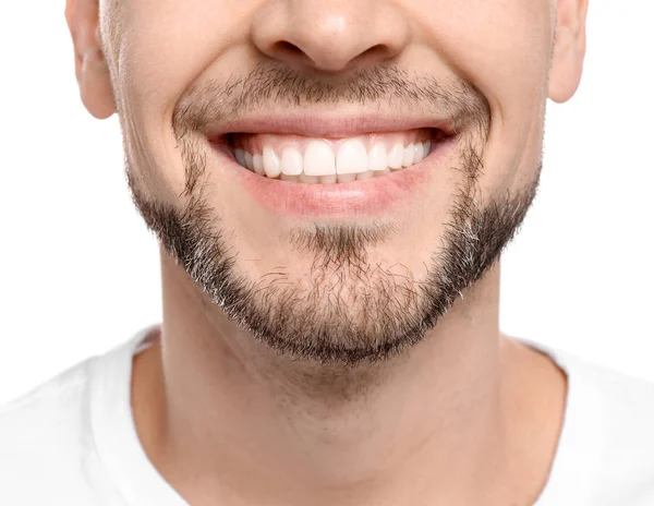 Junger Mann mit schönem Lächeln auf weißem Hintergrund. Zahnaufhellung — Stockfoto