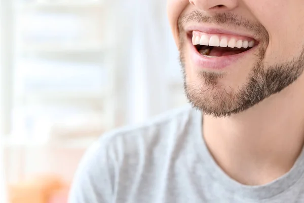 Νεαρός άνδρας με το όμορφο χαμόγελο σε εσωτερικούς χώρους. Λεύκανση δοντιών — Φωτογραφία Αρχείου