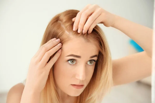 Mujer joven con problemas de pérdida de cabello sobre fondo claro — Foto de Stock