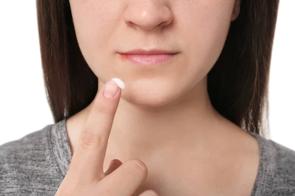 Mujer joven que aplica crema de herpes labial en los labios, primer plano —  Fotos de Stock