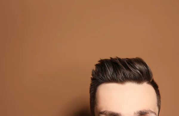 Молодий чоловік з проблемою втрати волосся на кольоровому фоні — стокове фото