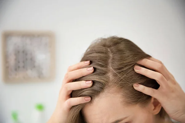 Mujer joven con problemas de pérdida de cabello en interiores —  Fotos de Stock