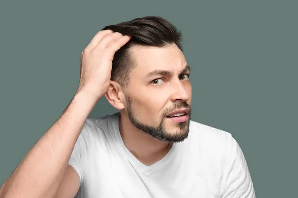 Junger Mann mit Haarausfall-Problem vor farbigem Hintergrund — Stockfoto