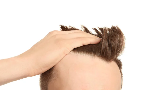 Giovane uomo con problema di perdita di capelli su sfondo bianco — Foto Stock