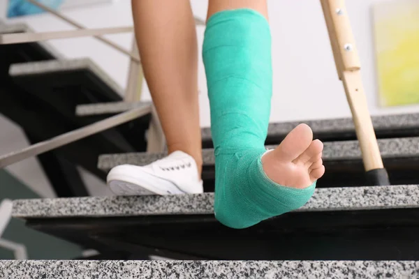 Junge Frau mit Krücke und gebrochenem Bein im Gips auf Treppe — Stockfoto