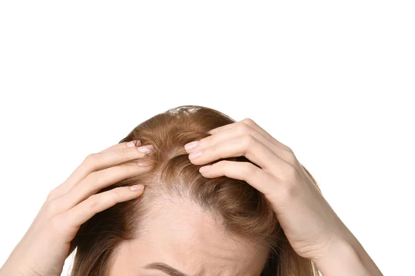 Junge Frau mit Haarausfall Problem auf weißem Hintergrund — Stockfoto