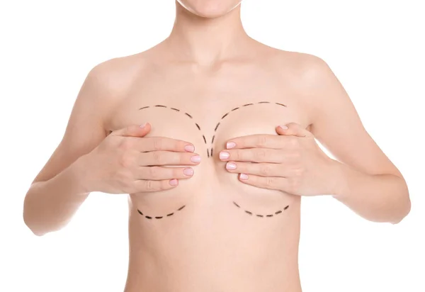 Молодая женщина с отметинами на груди для косметической операции на белом фоне — стоковое фото