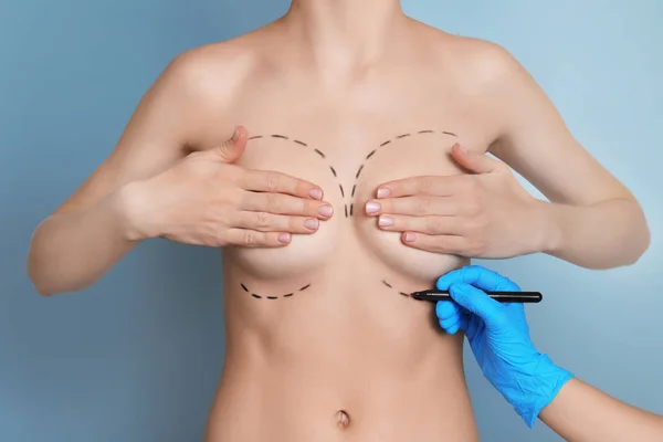 Doctor drawing marks on female breast for cosmetic surgery operation against color background — Stock Photo, Image