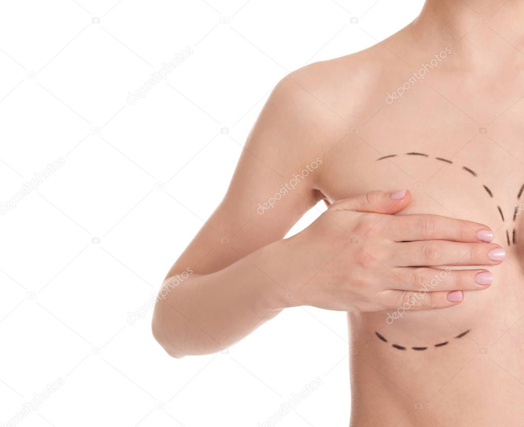 Young woman with marks on breast for cosmetic surgery operation against white background