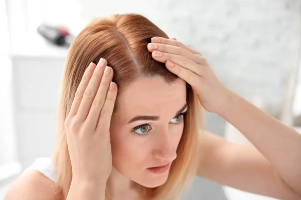 Young woman with hair loss problem at home — Stock Photo, Image