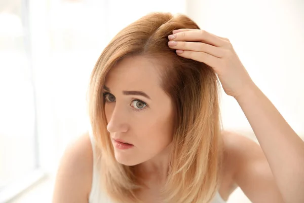 Young woman with hair loss problem on light background — Stock Photo, Image