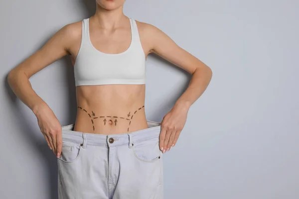 Mujer joven con marcas en el vientre en jeans grandes después de la operación de cirugía estética contra el fondo de color —  Fotos de Stock