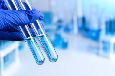 Doktor, laboratuarda analiz için numunelerle test tüpleri tutuyor.