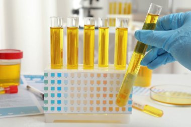 Doktor laboratuarda analiz için idrar örneğiyle test tüpünü tutuyor.