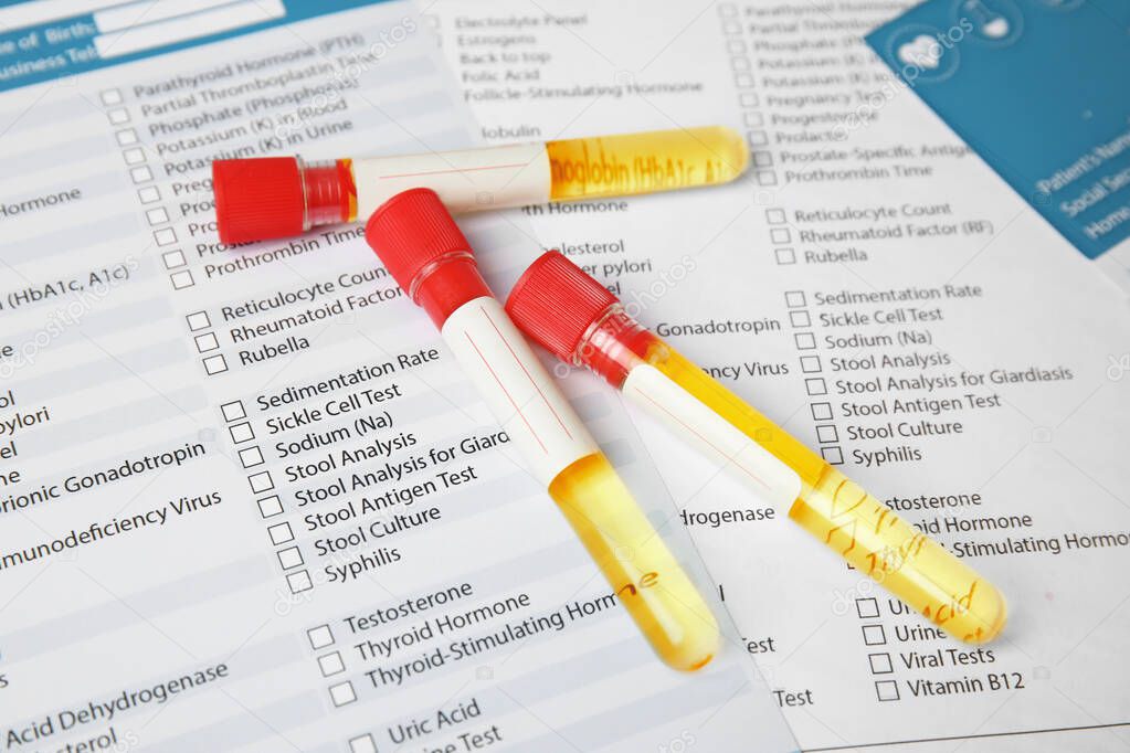 Test tubes with urine samples for analysis on laboratory test form