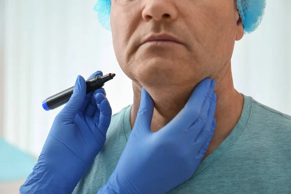 Chirurg s markerem připravuje člověka na operaci na klinice, zblízka — Stock fotografie