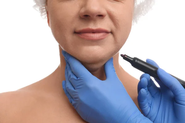 Ahli bedah dengan penanda mempersiapkan wanita untuk operasi terhadap putih — Stok Foto