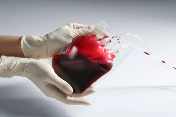 Mujer Sosteniendo Sangre Para Transfusión Sobre Fondo Claro Primer Plano — Foto de Stock