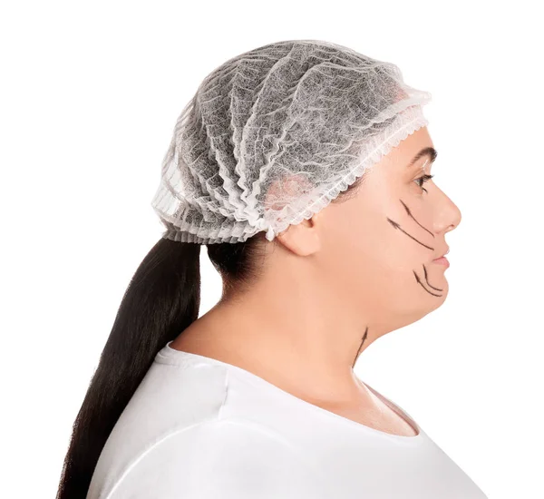 Žena s dvojitou bradou připravena na kosmetickou chirurgii na w — Stock fotografie