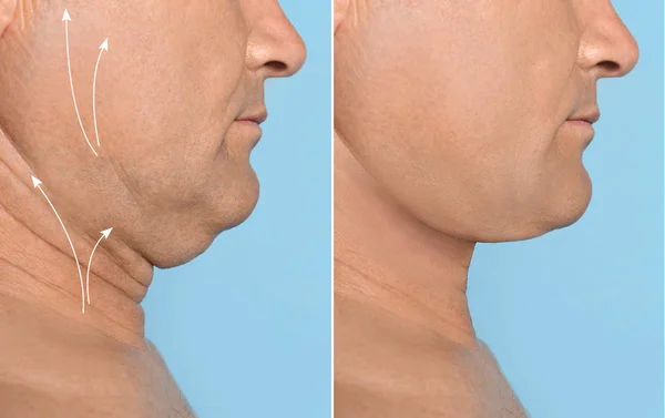 Mature man with double chin on white background, closeup  