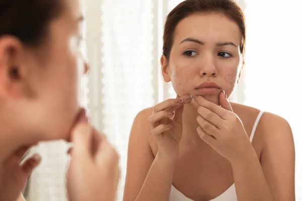 Teen girl with acne problem squeezing pimple near mirror in bath — Stock Photo, Image