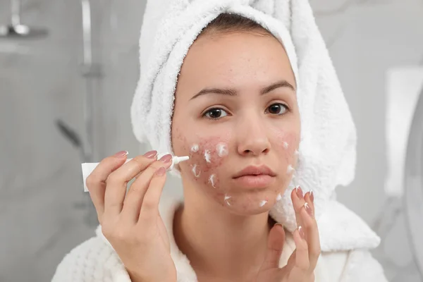 Teen girl with acne problem applying cream in bathroom — Stock Photo, Image