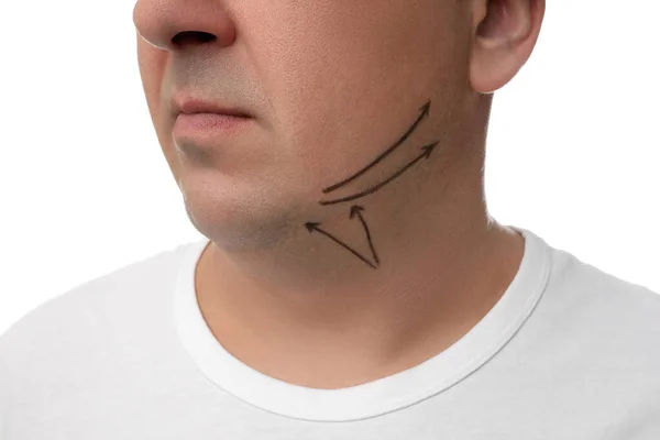 Homem maduro com marcas no rosto contra fundo branco, close-up . — Fotografia de Stock