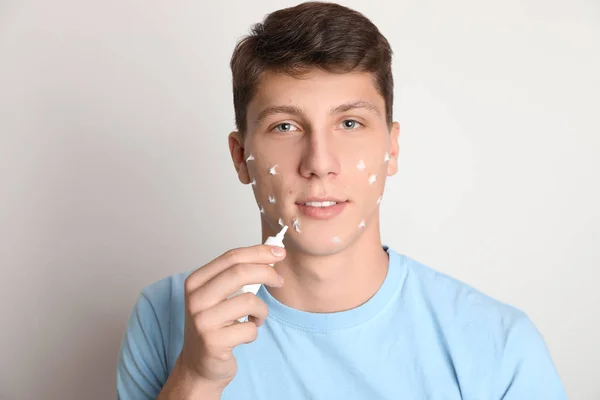 Adolescent guy avec acné problème application crème sur lumière fond — Photo