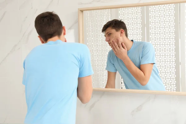 Adolescente cara com problema de acne perto do espelho no banheiro — Fotografia de Stock