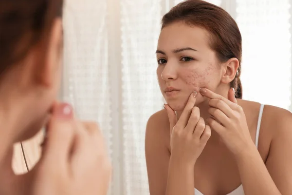 Teen girl with acne problem squeezing pimple near mirror in bath — Stock Photo, Image