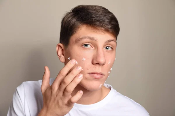 Adolescent guy avec acné problème application crème sur beige fond — Photo
